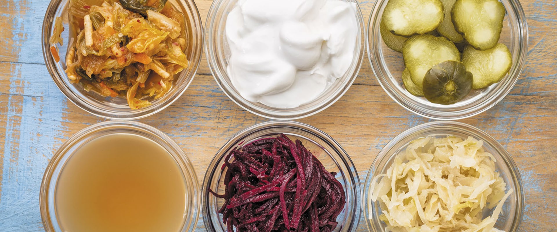 Probiotic Foods for Gut Health: The Ultimate Guide